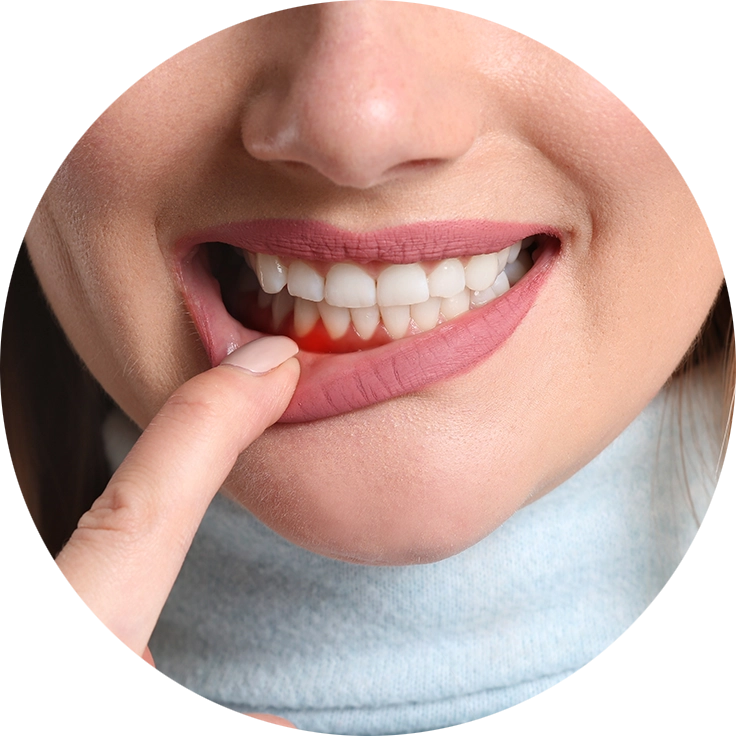 Баннер Рецессия десны